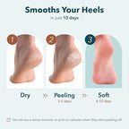 Purederm Exfoliating Heel Mask – Heel Peeling masks gently remove calluses from - Image 3