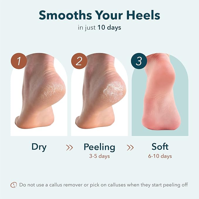 Purederm Exfoliating Heel Mask – Heel Peeling masks gently remove calluses from - Image 3