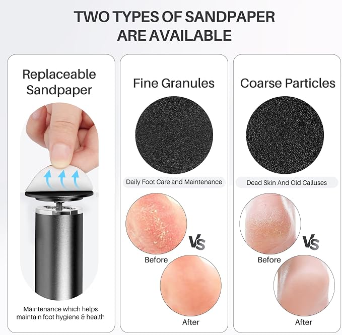 Foot File Callus Remover for Feet: Profesional Pedicure Tool for SPA - Image 6