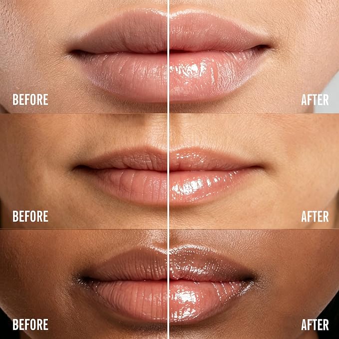 KIMUSE Lip Mask Set, Moisturize & Nourish, Cracked Dry Lips, Intense Hydration - Image 2