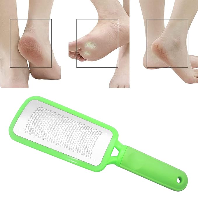 Professional Foot Files Callus Remover, Foot Scrubber - Image 5