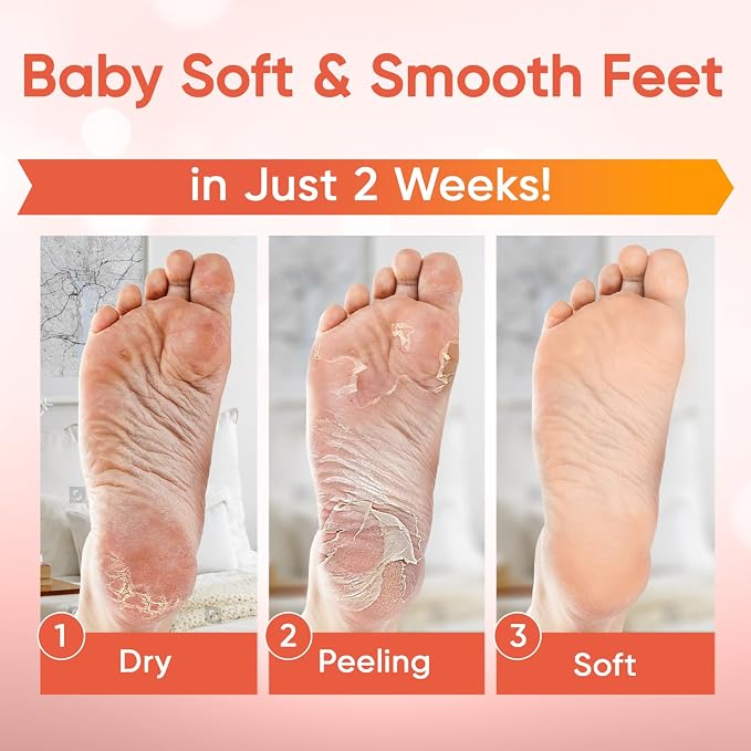 CÉLOR Foot Peeling Mask for Dry Cracked Feet | Foot Mask to Exfoliate Rough - Image 2