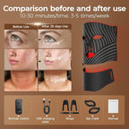 ONLUKY Red Light Therapy for Face, LED Face Mask Light Therapy - Image 2