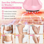 Lymphatic Drainage Massager, Anti Cellulite Massage Tool - Image 6