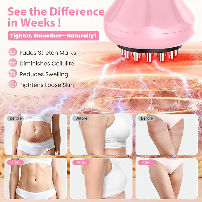 Lymphatic Drainage Massager, Anti Cellulite Massage Tool - Image 6