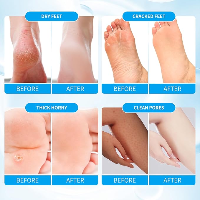 Pedicure Kit Foot Soak Set: Bubble Salt, Sugar Scrub, Massage Mask, Massage - Image 2