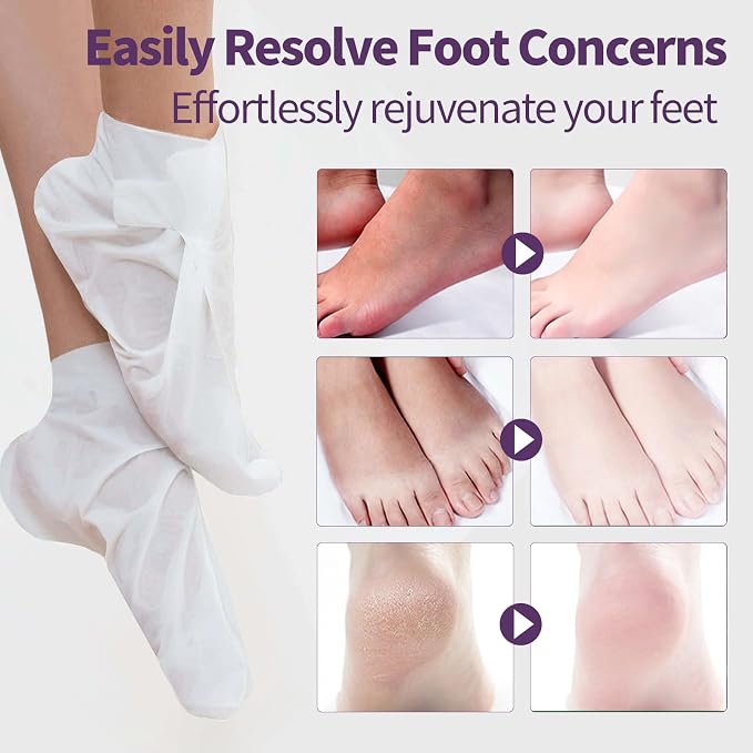 6 Pack Moisturizing Foot Mask, Hydrating Foot Masks - Image 4