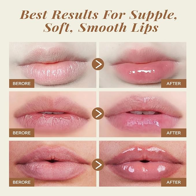 ANAI RUI Coconut Lip Scrub & Lip Mask Set - Image 4