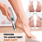 Powerful Electric Foot Callus Remover - Image 5