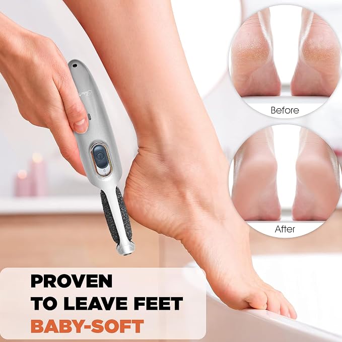 Powerful Electric Foot Callus Remover - Image 5