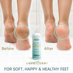 Callus Remover for Feet Foot Callus Remover Gel - Image 3