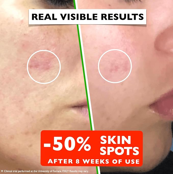 Vitamin C Serum For Face – Anti Aging Face Serum - Image 4
