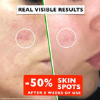Vitamin C Serum For Face – Anti Aging Face Serum - Image 4