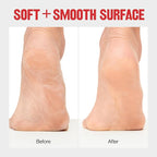 Revlon Callus Remover, Foot File - Image 4