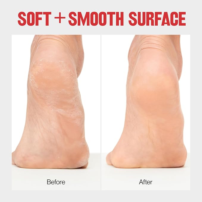Revlon Callus Remover, Foot File - Image 4