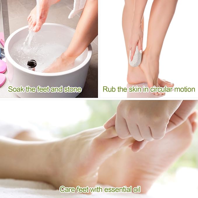 2PCS Natural Pumice Stone, Asqraqo Lava Pedicure Tools Hard Skin Callus Remover - Image 3