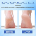 Veinsgrain Foot File, Nano Glass Foot File, Hard Skin Remover Nano-Glass Foot - Image 3