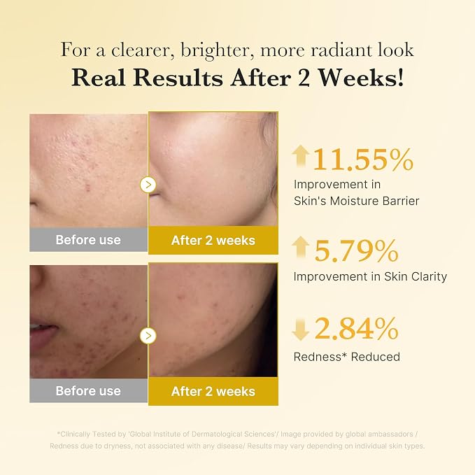 medicube Kojic Acid Turmeric Clarifying & Balancing Capsule Serum - Image 5