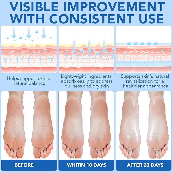 ABOUME 60% Urea Foot Care Stick - Image 4