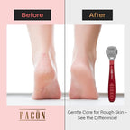 Facón Professional Callus Shaver Remover - Image 3