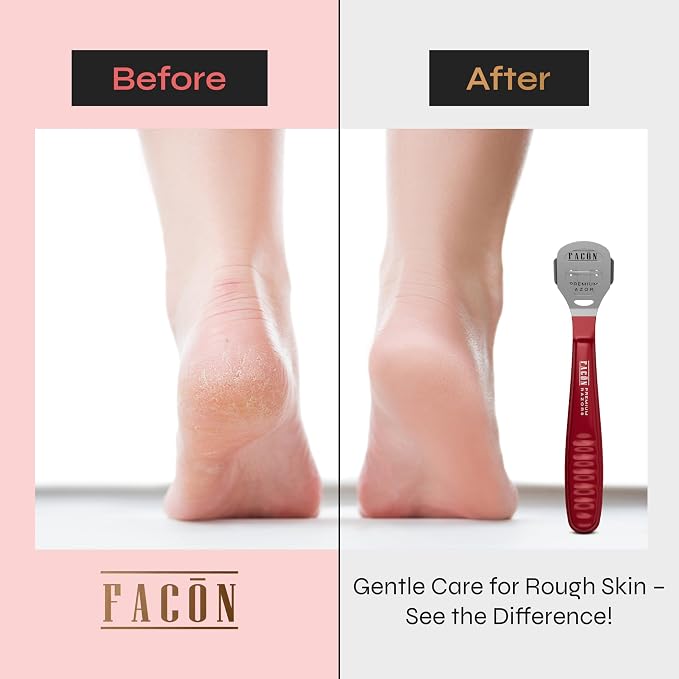 Facón Professional Callus Shaver Remover - Image 3