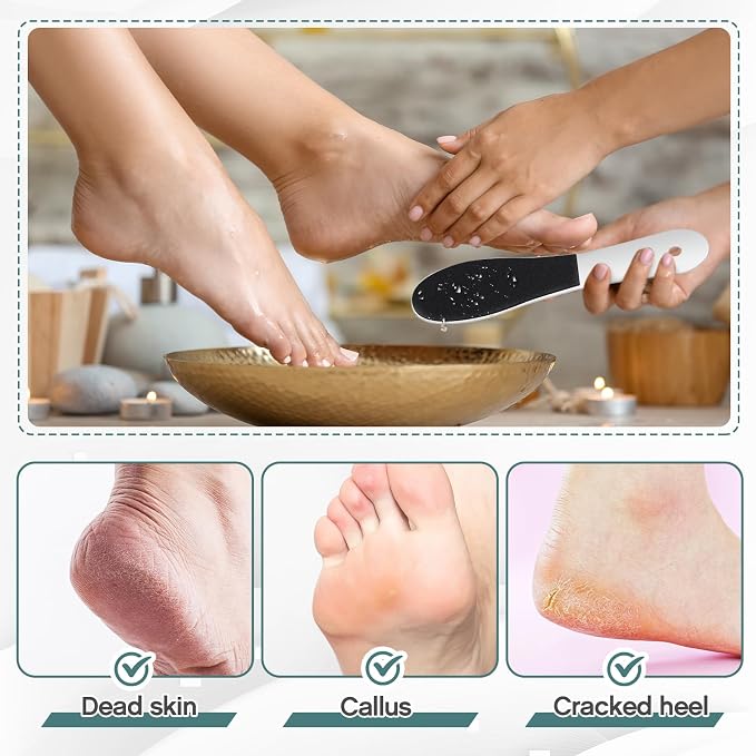 Lothee 30 Pack Foot File Foot Callus Remover Double Sided Professional - Image 6