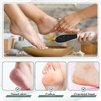 Lothee 30 Pack Foot File Foot Callus Remover Double Sided Professional - Image 6