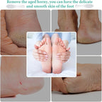 1 Pcs Stainless Steel Foot File Callus Remover Double Sided Metal Foot Rasp - Image 5