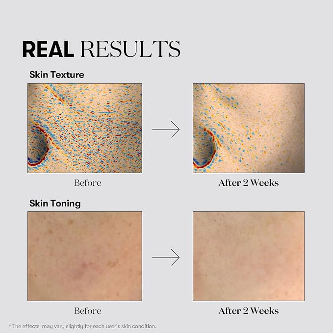VT COSMETICS TX Toning Daily Mask 30 Sheets, Tranexamic Acid, Niacinamide - Image 4