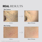 VT COSMETICS TX Toning Daily Mask 30 Sheets, Tranexamic Acid, Niacinamide - Image 4