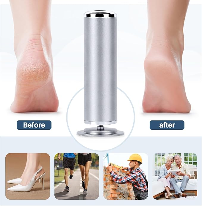 Electric Foot File Remover Callus: Profesional Pedicure Tool - Image 6