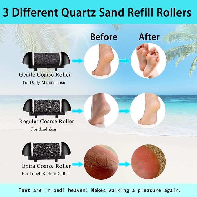 Electric Foot Callus Remover- Long Service Time, Rechargeable Electronic Foot - Image 5