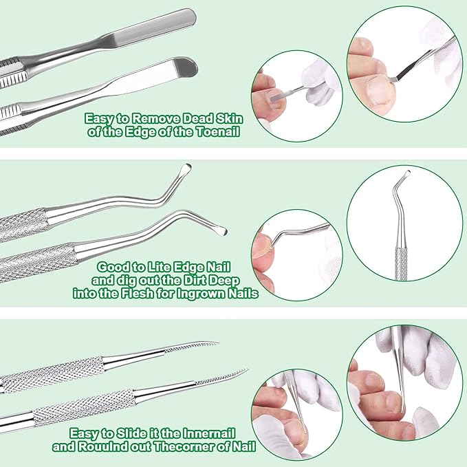 6-Pack Ingrown Toenail File and Lifters, Professional Surgical Stainless Steel - Image 4