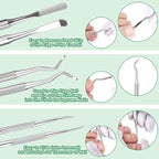 6-Pack Ingrown Toenail File and Lifters, Professional Surgical Stainless Steel - Image 4