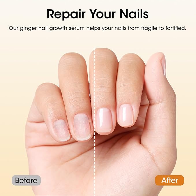 Gellen 30ml Ginger Nail Growth Serum - Image 7