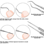 ZIZZON 7 Pcs Ingrown Toenail File and Lifters Set, Stainless Steel Ingrown - Image 4