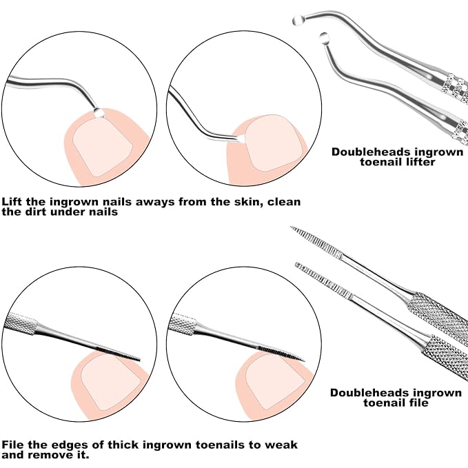 ZIZZON 7 Pcs Ingrown Toenail File and Lifters Set, Stainless Steel Ingrown - Image 4
