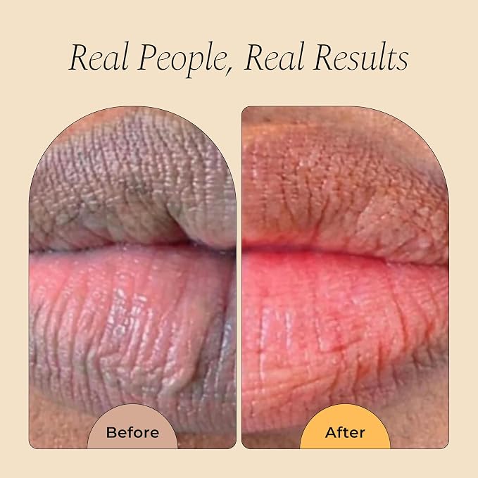 Glo Melanin All Natural Lemon and Turmeric Lip Balm - Image 3