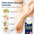 Callus Remover for Feet with Extra Strength Gel & Foot Pumice Stone Set - Image 2