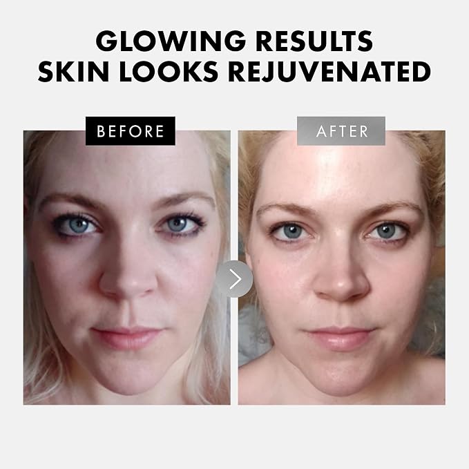 Eclat Skincare Face Serum Set – Vitamin C & Retinol Serum - Image 3