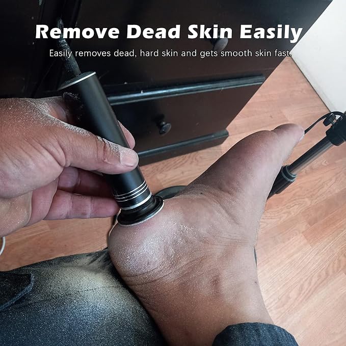 Upgraded Electric Callus Remover - Image 2