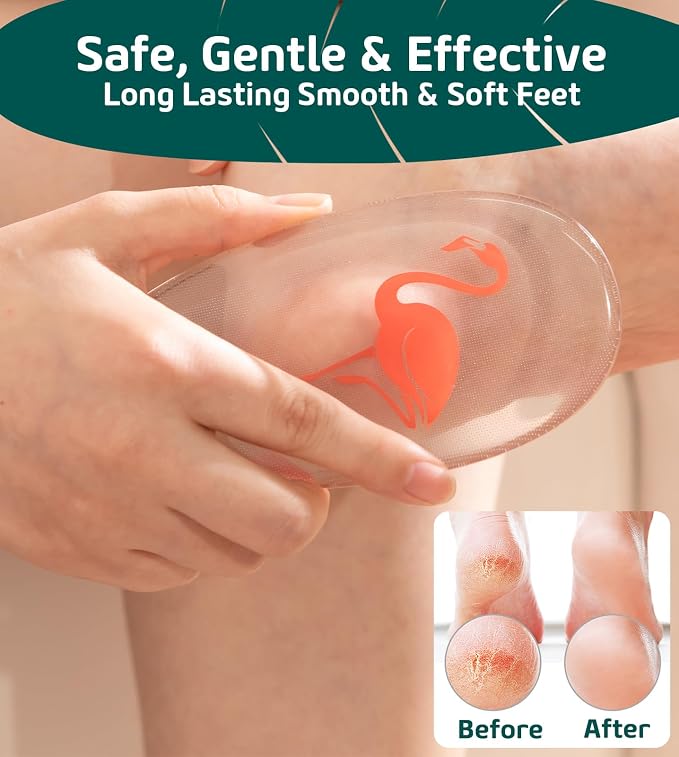 Glass Foot File Callus Remover for Feet, Flamingo Gifts for Women, Feet - Image 3