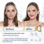 HIQILI 30ML Chamomile Essential Oil, Pure & Natural Chamomile Oil - Image 2
