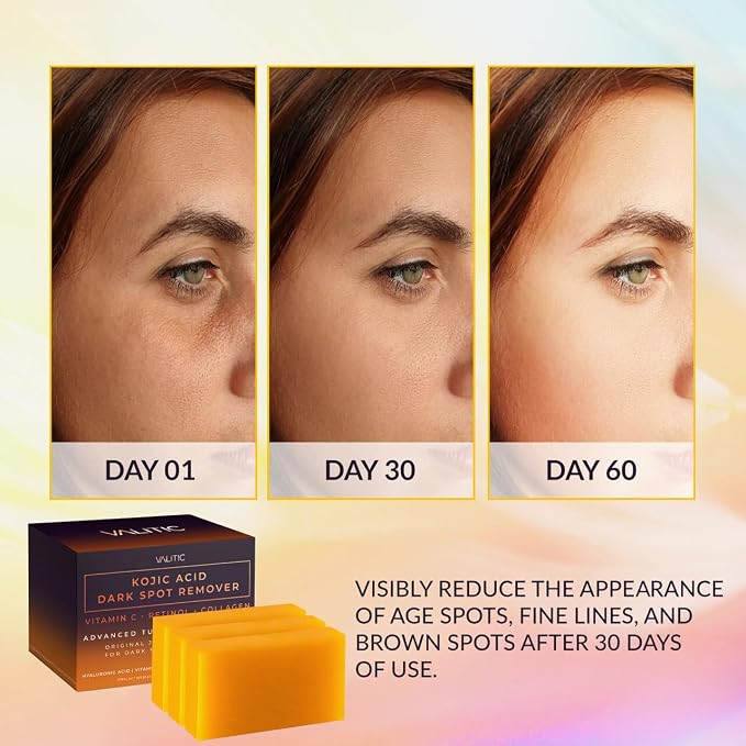 VALITIC Kojic Acid Dark Spot Corrector Soap Bars - Image 2