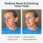 MAREE Glycolic Acid Pads – Toner Pads - Image 4