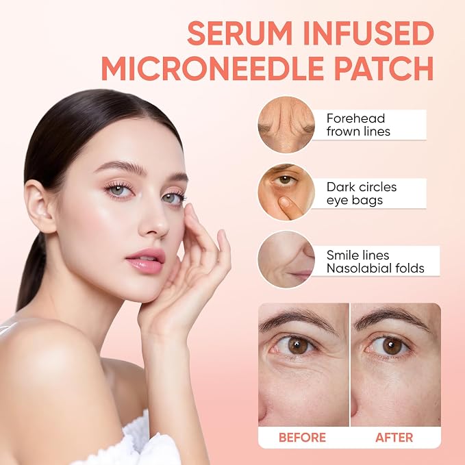MicroGlow Eye Patches, Under Eye Patchs Hyaluronic Acid Eye Mask - Image 2