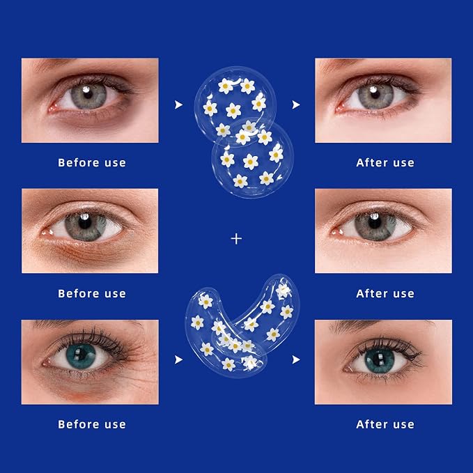 ZNÖCUETÖD Gel Ice Pack Reusable Cooling Eye Pads and Under Eye Patches - Image 6