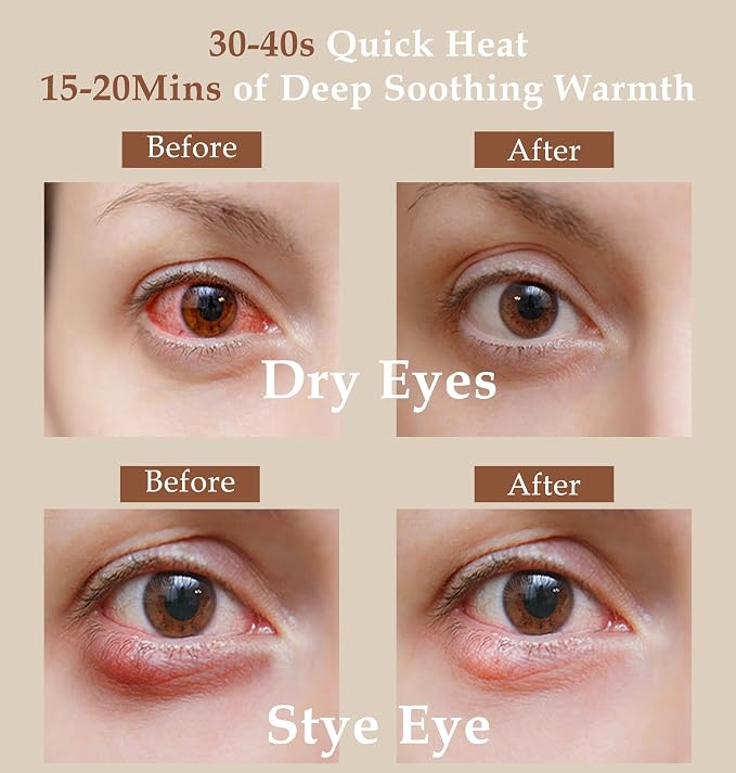 Heated Eye Mask, Moist Warm Compress Microwave - Image 3