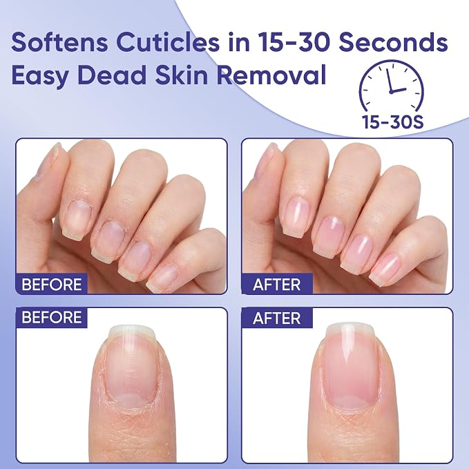 Ceramic Cuticle Pusher & Oil Pen + Cuticle Remover Gel – Gentle Nail Care Kit - Image 6