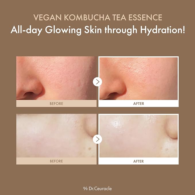 Dr.Ceuracle Vegan Kombucha Tea Essence - Image 3